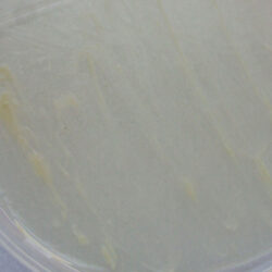 Mycobacterium abscessus